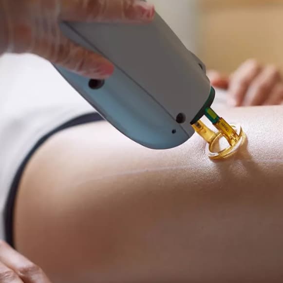 Full Brazilian + Axilas at Loba Beauty Spa in Kearny, NJ