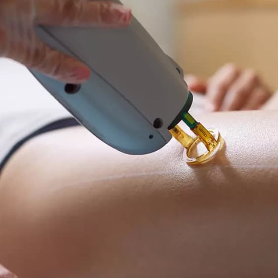 Half Legs + Brazilian + Axilas at Loba Beauty Spa in Kearny, NJ